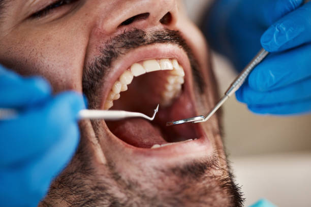 Best Dental Abscess Treatment in Manning, IA
