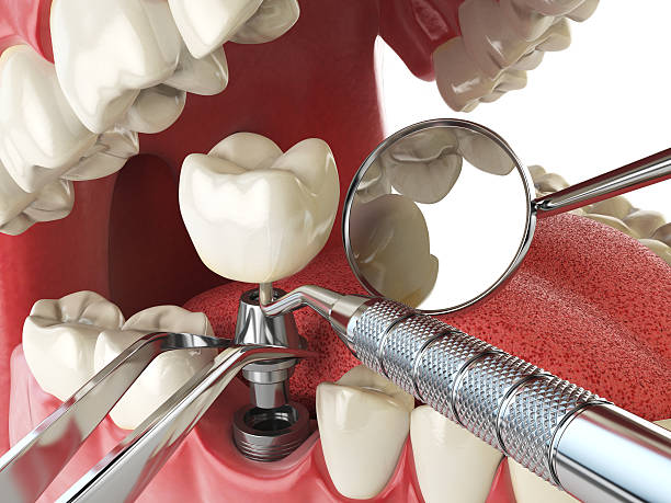 Best Emergency Dental Care for Sports Injuries in Manning, IA